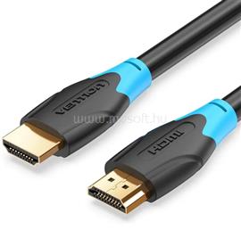 VENTION HDMI 1,5m kábel (fekete) AACBG small
